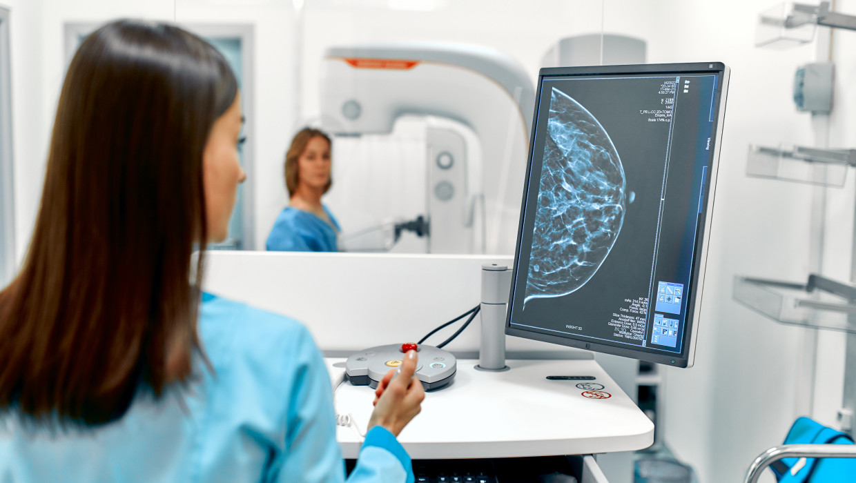 Una mujer mira la pantalla mientras realiza una mamografía