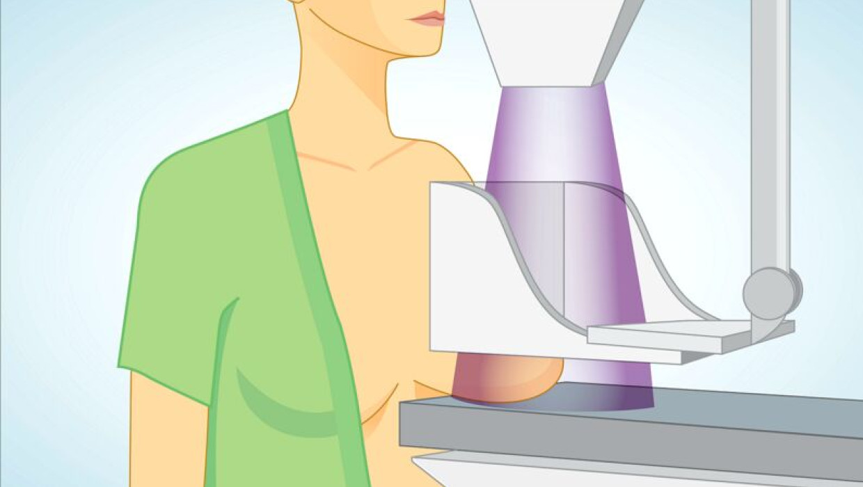 ilustración mamografías