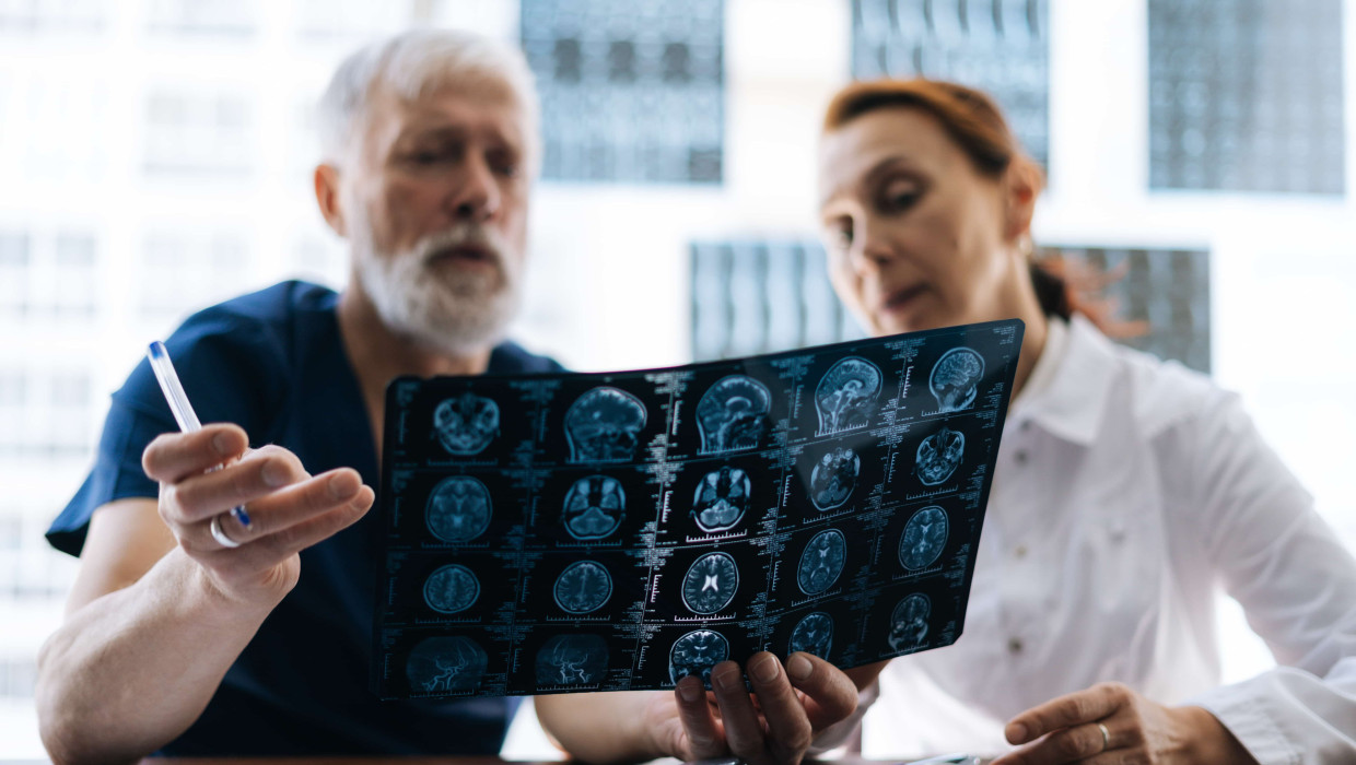 Equipo médico analizando imágenes de un cerebro