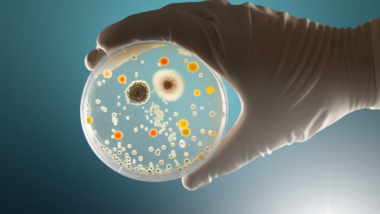Placa de agar llena de bacterias