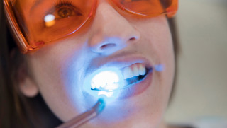 Mujer con gafas de protección recibiendo tramiento de blanqueamiento dental