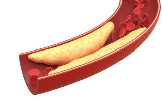Grasa y glóbulos rojos en vaso sanguíneo